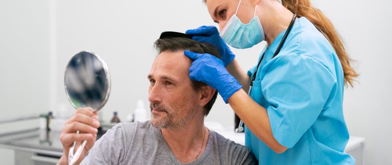 Real Hair Transplant Results and Testimonials