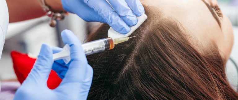 How Much Does a Hair Transplant Really Cost